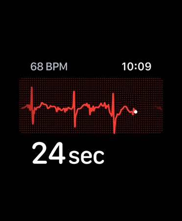 App ECG com batimentos por minuto no canto superior esquerdo, por cima do ritmo e do temporizador